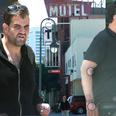 jason walking on the street looking sickly and bruises in his hand 